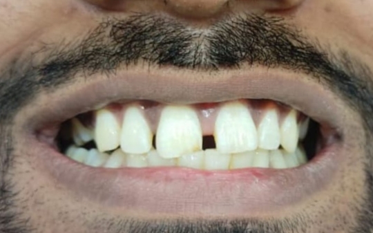 Before Dental Treatment