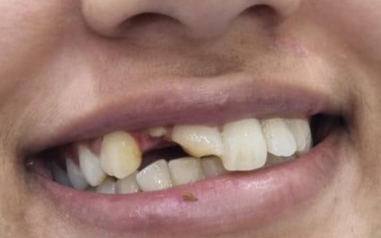 Before Dental Treatment