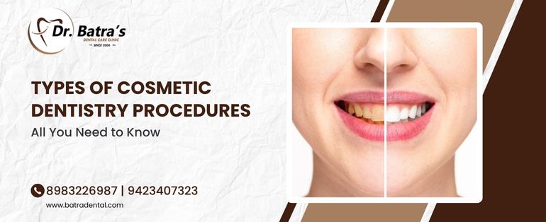 Types of Cosmetic Dentistry Procedures – All You Need to Know