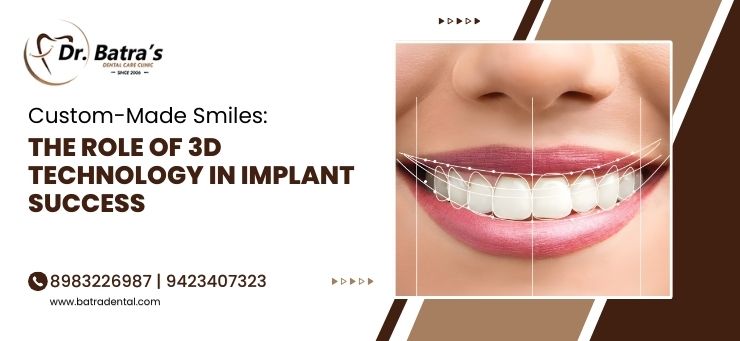 dental implant treatment in Bhandara