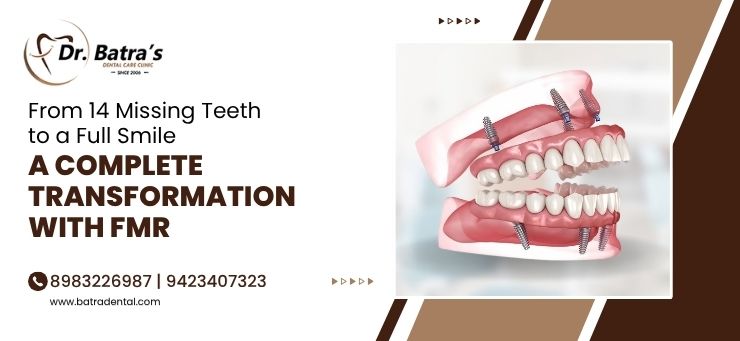 full mouth rehabilitation in bhandara